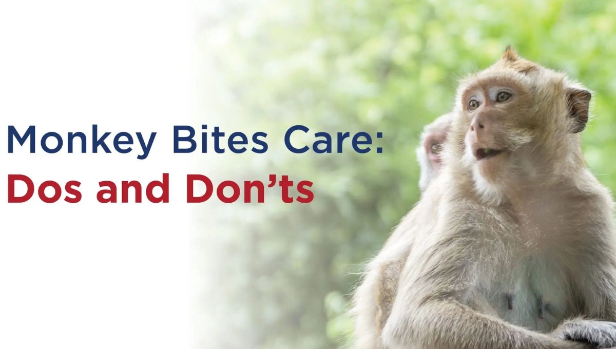 Monkey Bites: Immediate Care and Prevention Tips You Must Know