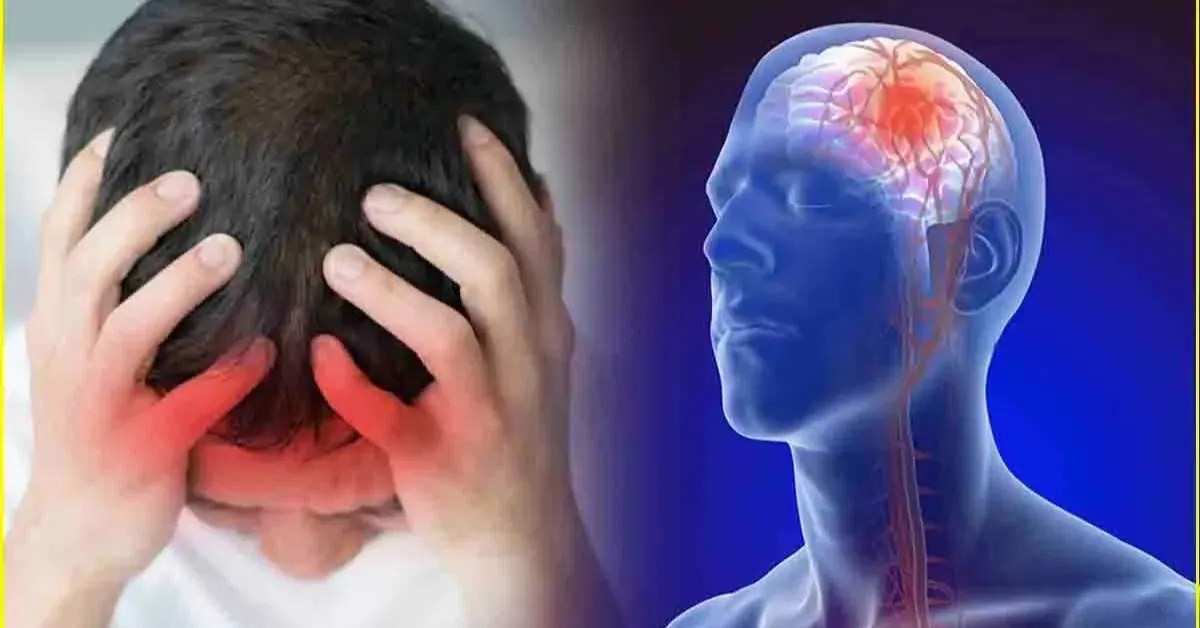 Silent Stroke: The Hidden Brain Damage You Never Feel Coming